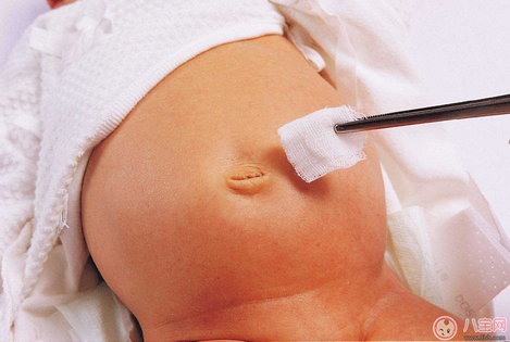 新生兒的臍帶要多久才脫落 寶寶臍帶脫落后如何護理 新生兒的臍帶要多久才脫落 寶寶臍帶脫落后如何護理