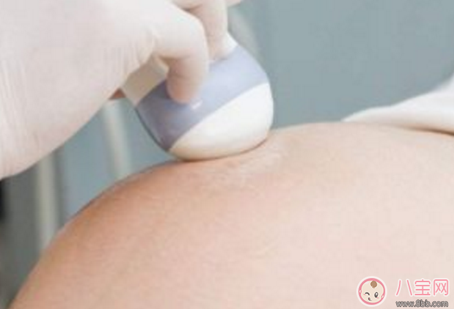 孕早期可以做陰道B超嗎 孕早期陰道B超有沒有必要做呢 孕早期可以做陰道B超嗎 孕早期陰道B超有沒有必要做呢