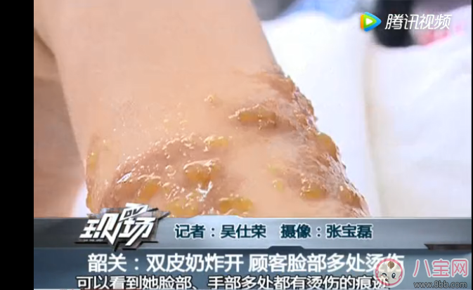 雙皮奶為什么會爆炸 雙皮奶窩蛋要加熱了吃嗎 雙皮奶為什么會爆炸 雙皮奶窩蛋要加熱了吃嗎