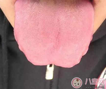 孩子脾虛怎么進行調理 孩子脾虛按哪里比較好