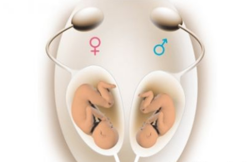 懷孕七周能不能知道性別 汪小菲否認大懷男孩真的嗎 懷孕七周能不能知道性別 汪小菲否認大懷男孩真的嗎