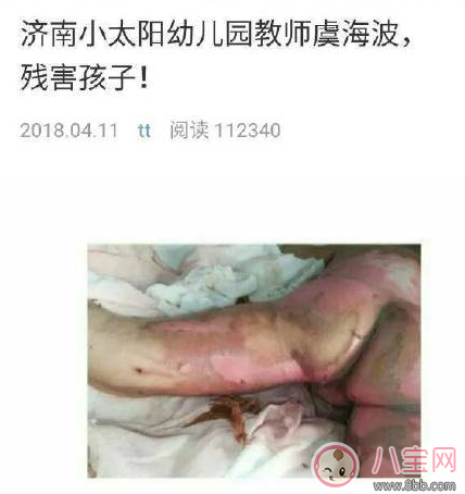 濟(jì)南小太陽幼兒園虐童事件原文 教師虞海波殘害孩子原文