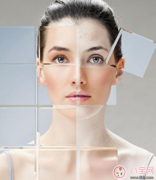 曬后如何修復 曬后修復美白小偏方有哪些