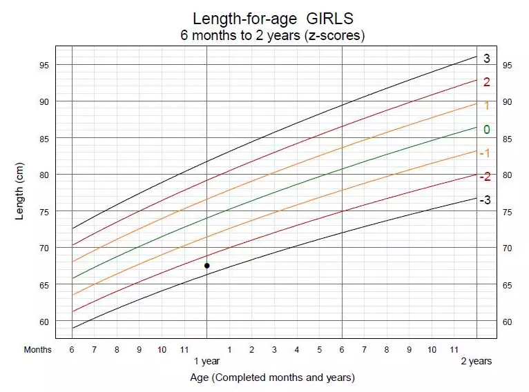怎么知道孩子的發育是不是正常 判斷孩子發育是否正常方法 怎么知道孩子的發育是不是正常 判斷孩子發育是否正常方法