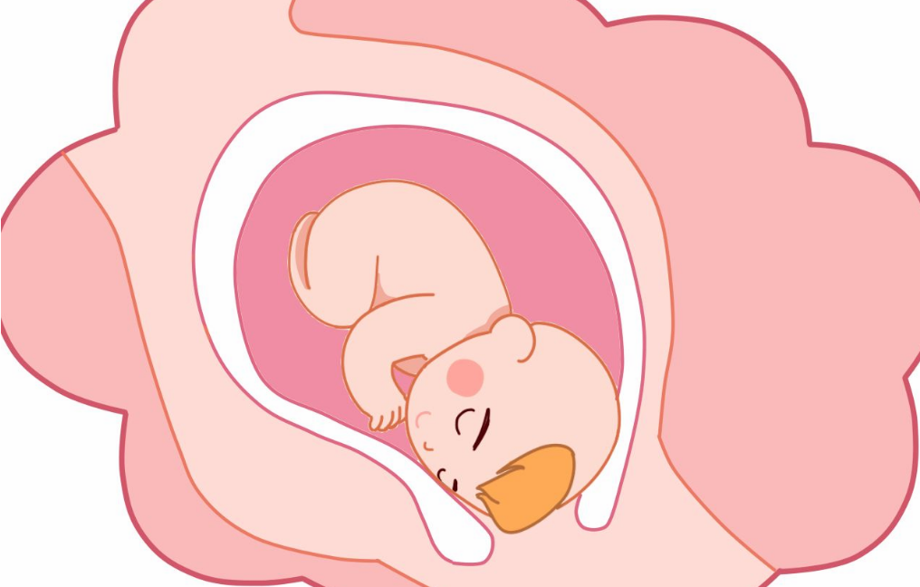 什么原因導致低羊水 如何預防羊水過少