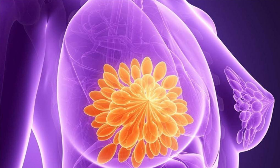 有乳腺增生怎么調理 得乳腺增生的原因是什么