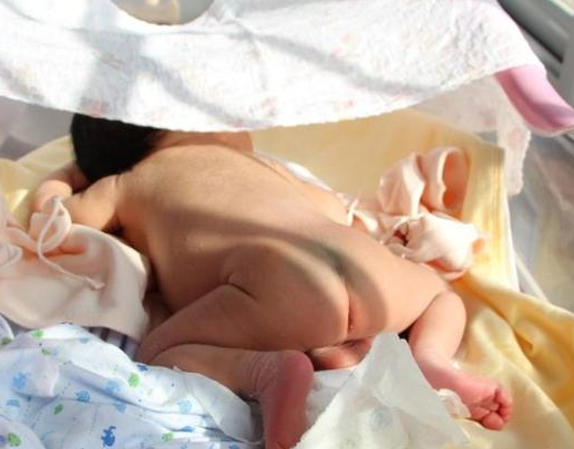 嬰兒長濕疹能曬太陽嗎 濕疹曬太陽后會怎么樣