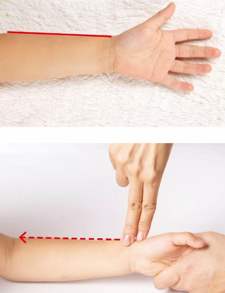 推拿對寶寶濕疹有用嗎 寶寶濕疹推拿按摩方法