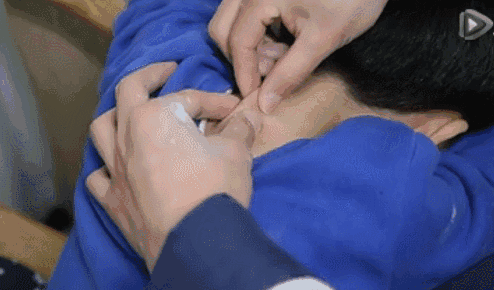 小兒推拿手法圖解 孩子生病后推拿具體手法分享