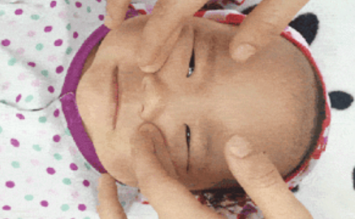 寶寶流鼻涕按摩哪里好 小孩流鼻涕推拿手法 寶寶流鼻涕按摩哪里好 小孩流鼻涕推拿手法