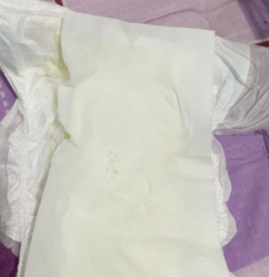 大王棉花糖和moony哪個好 大王棉花糖和尤妮佳紙尿褲對比測評 大王棉花糖和moony哪個好 大王棉花糖和尤妮佳紙尿褲對比測評