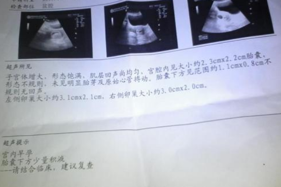 胎停育后成功懷孕經(jīng)驗(yàn) 胎停一個(gè)月后立刻懷孕寶寶健康出生