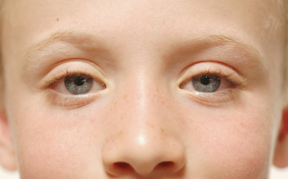 孩子的鼻子有鼻屎怎么清理好 孩子鼻子經常出問題怎么辦好