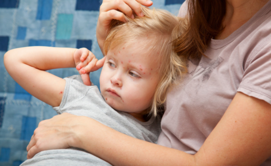 寶寶被蟲咬了起水泡怎么辦 2018夏季寶寶蟲咬皮炎如何處理 寶寶被蟲咬了起水泡怎么辦 2018夏季寶寶蟲咬皮炎如何處理