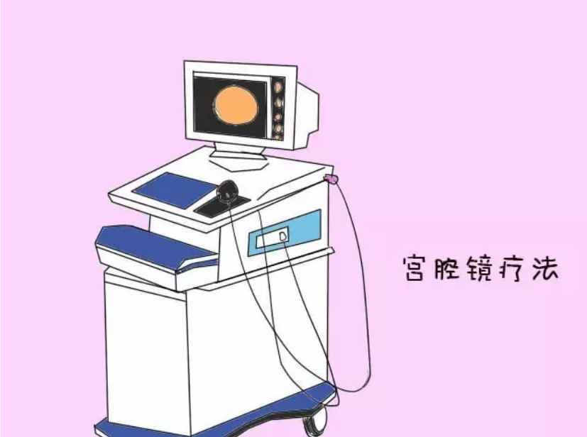 宮頸粘連可以做試管嬰兒嗎 宮頸粘連會不會影響試管成功率