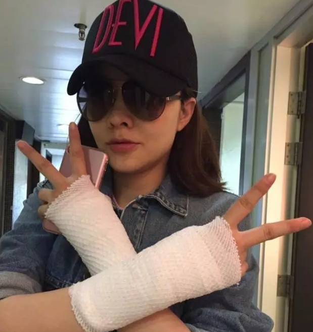 熊黛林媽媽手是什么 媽媽手怎么治療2018