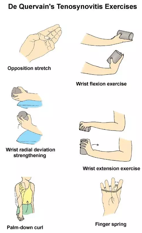 媽媽手腱鞘炎吃什么藥好 媽媽手腱鞘炎怎么治療2018