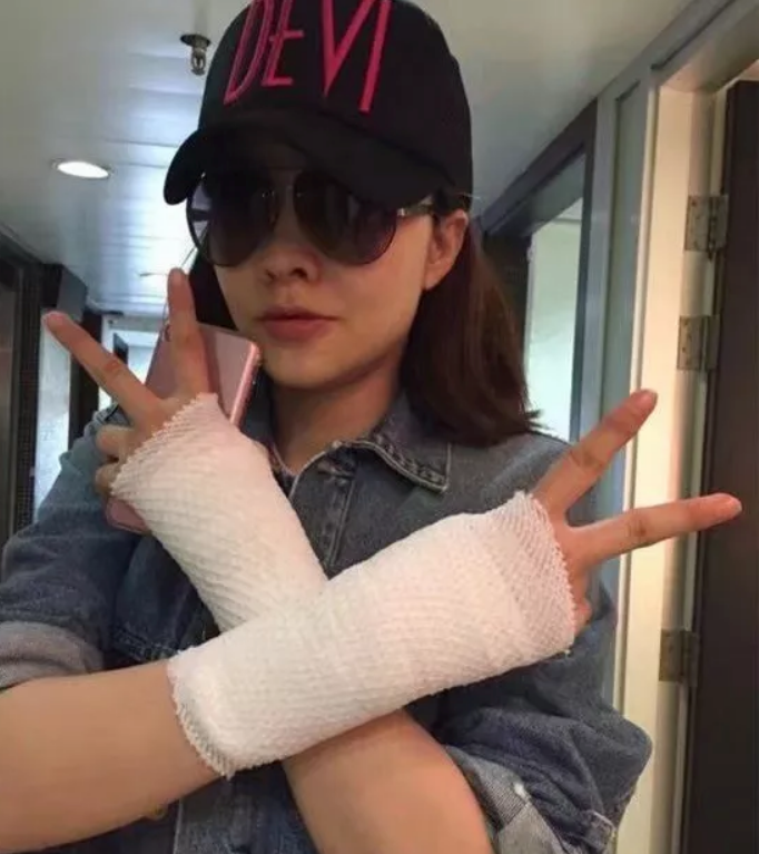 哪些習慣容易患媽媽手 媽媽手腱鞘炎怎么治療 哪些習慣容易患媽媽手 媽媽手腱鞘炎怎么治療