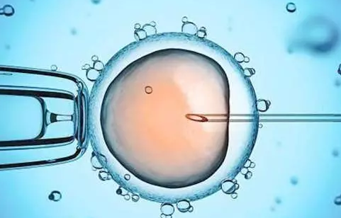 試管嬰兒怎么選擇嬰兒性別 做試管嬰兒怎么生男孩 試管嬰兒怎么選擇嬰兒性別 做試管嬰兒怎么生男孩