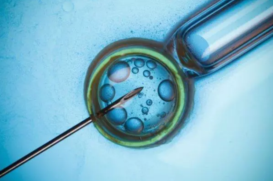 跳繩能疏通輸卵管嗎 輸卵管堵塞能疏通嗎 跳繩能疏通輸卵管嗎 輸卵管堵塞能疏通嗎