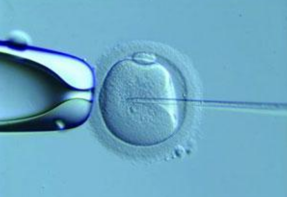 試管嬰兒會(huì)卵巢早衰嗎 做試管嬰兒時(shí)為什么要促排卵