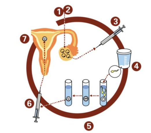 卵巢位置不好怎么取卵2018 為什么每個人排卵數量不一樣 卵巢位置不好怎么取卵2018 為什么每個人排卵數量不一樣