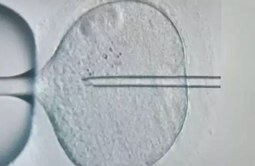 睪丸穿刺取精有多疼2018 試管嬰兒睪丸穿刺取精有危險嗎