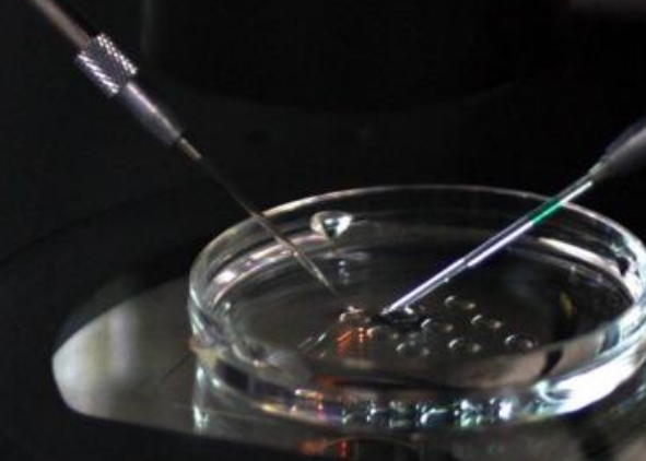 試管嬰兒過度刺激綜合征怎么辦 過度刺激綜合征有哪些影響 試管嬰兒過度刺激綜合征怎么辦 過度刺激綜合征有哪些影響