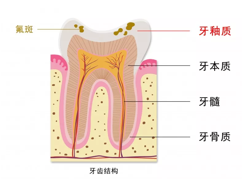 孩子刷牙齒不能用含氟牙膏嗎 孩子用含氟牙膏會(huì)變成氟斑牙嗎
