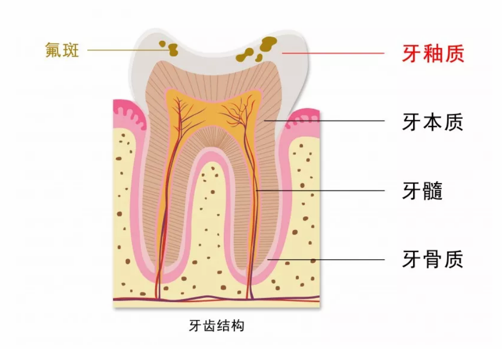 孩子用含氟牙膏會導(dǎo)致氟斑牙嗎 3歲以下的孩子有必要用含氟牙膏嗎 孩子用含氟牙膏會導(dǎo)致氟斑牙嗎 3歲以下的孩子有必要用含氟牙膏嗎