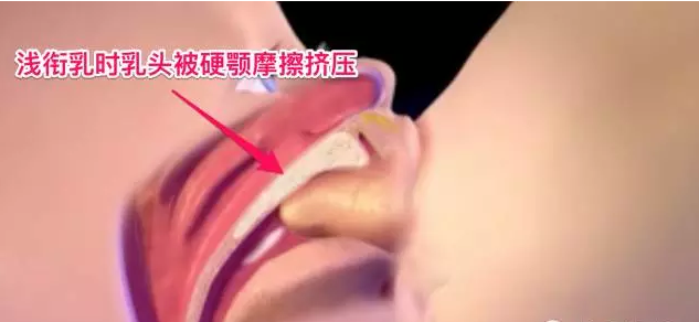 哺乳期乳房痛怎么辦 怎么緩解乳房疼痛2018