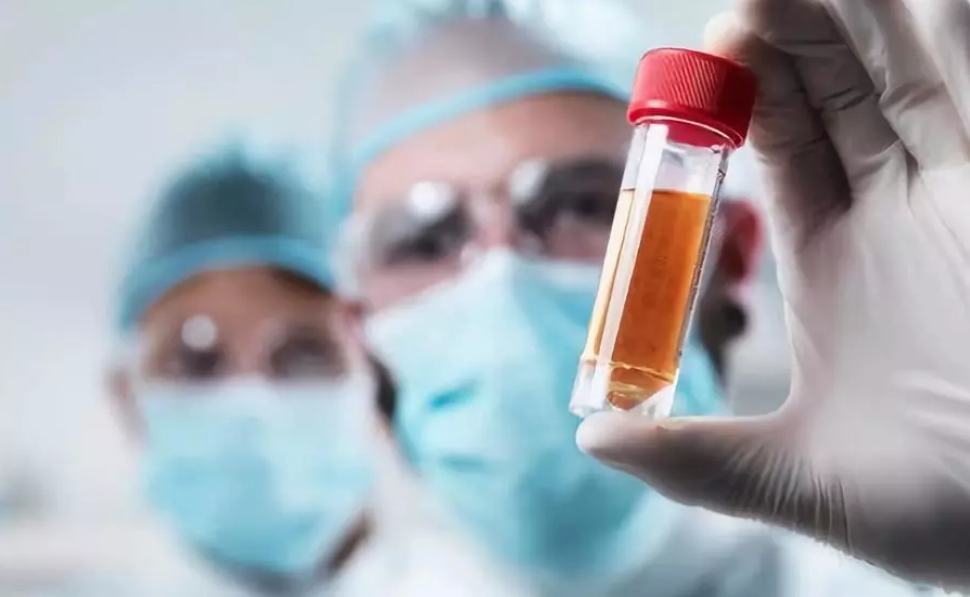 新生兒ABO溶血為什么要換血 如何預(yù)防新生兒ABO溶血 新生兒ABO溶血為什么要換血 如何預(yù)防新生兒ABO溶血