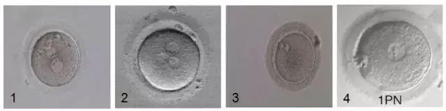 移植異常胚胎可發育為健康嬰兒嗎 移植異常胚胎可發育為健康嬰兒嗎