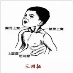 孩子吃西瓜噎住了怎么辦 西瓜肉卡喉嚨緊急處理方法2018