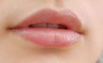 嘴唇總起皮怎么辦 怎么正確的護理唇部2018