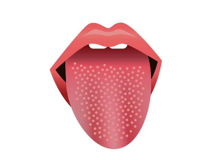 孩子猩紅熱會有什么特點 孩子猩紅熱癥狀是什么2018