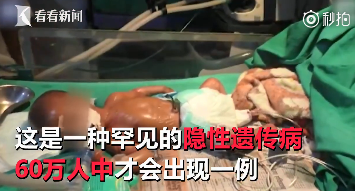 印度出現塑料嬰兒和環境有關嗎 印度塑料嬰兒能活多久 印度出現塑料嬰兒和環境有關嗎 印度塑料嬰兒能活多久