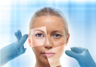 去漂流曬黑了怎么辦 漂流后曬黑了怎么白回來2018