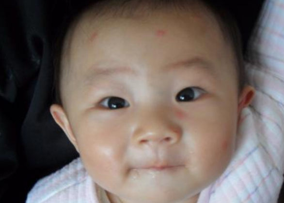 日本和光堂驅(qū)蚊貼寶有效果嗎 日本和光堂驅(qū)蚊貼寶寶用安全嗎 日本和光堂驅(qū)蚊貼寶有效果嗎 日本和光堂驅(qū)蚊貼寶寶用安全嗎