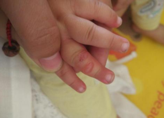 日本和光堂驅蚊胺啫喱怎么樣 日本和光堂驅蚊胺啫喱寶寶用安全嗎