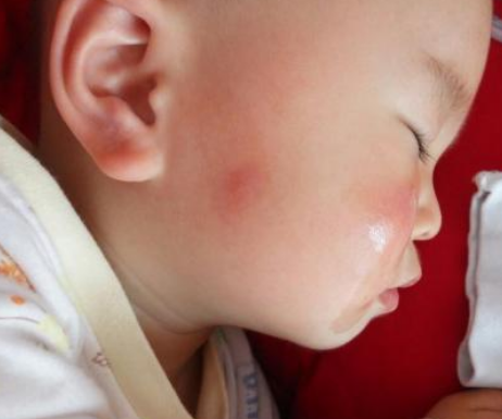 澳洲Aerogard驅(qū)蚊噴霧寶寶能用嗎 澳洲Aerogard驅(qū)蚊噴霧寶寶用安全嗎 澳洲Aerogard驅(qū)蚊噴霧寶寶能用嗎 澳洲Aerogard驅(qū)蚊噴霧寶寶用安全嗎