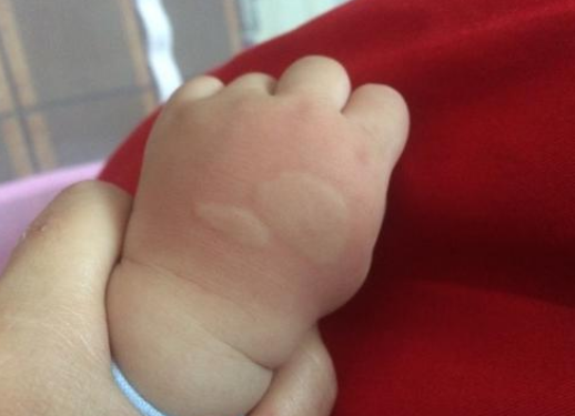 六神驅蚊花露水多大寶寶能用 寶寶用六神驅蚊花露水安全嗎 六神驅蚊花露水多大寶寶能用 寶寶用六神驅蚊花露水安全嗎