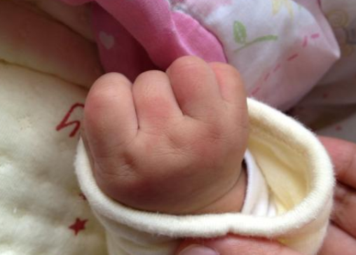 寶寶夏日防蚊止癢小妙招 寶寶怎么有效預防蚊蟲叮咬