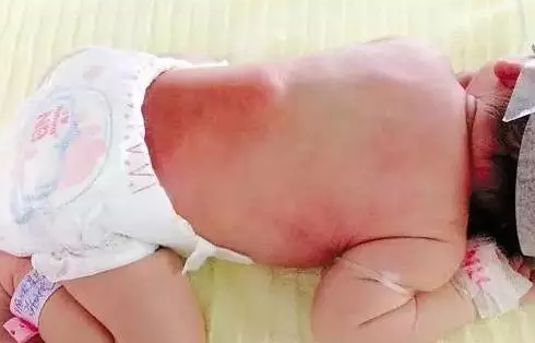 寶寶睡草席和竹席好嗎 寶寶睡涼席要注意什么2018