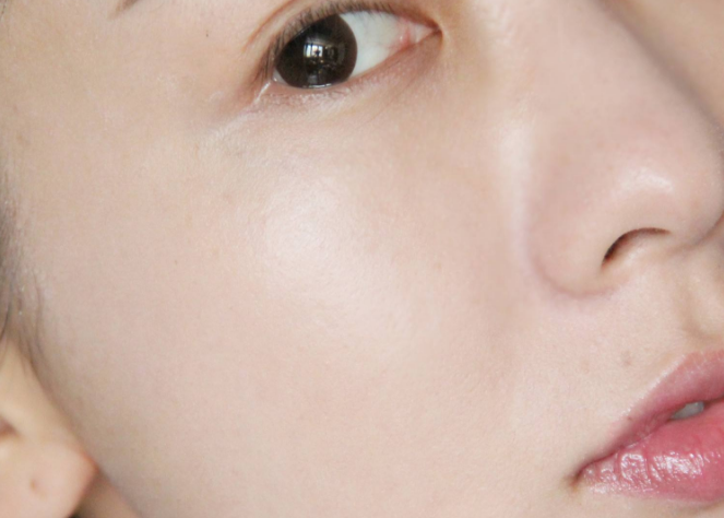 毛孔粗大是什么原因?qū)е碌?怎么改善毛孔粗大的情況