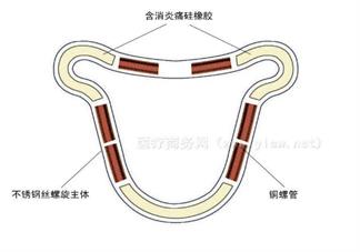絕經(jīng)后節(jié)育環(huán)要取出來嗎 2018絕經(jīng)后癥狀調(diào)整