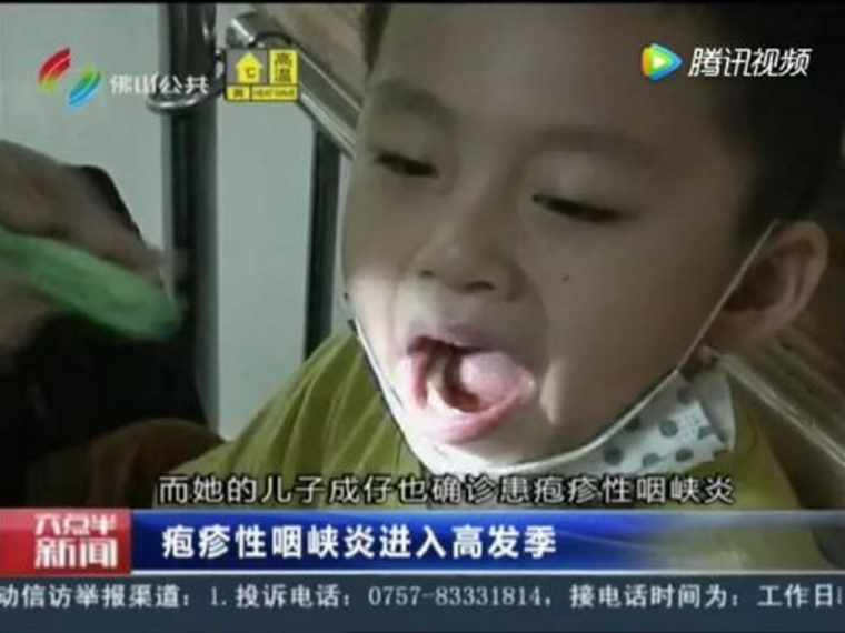 孩子得手足口和皰疹性咽峽炎到底怎么區分2018