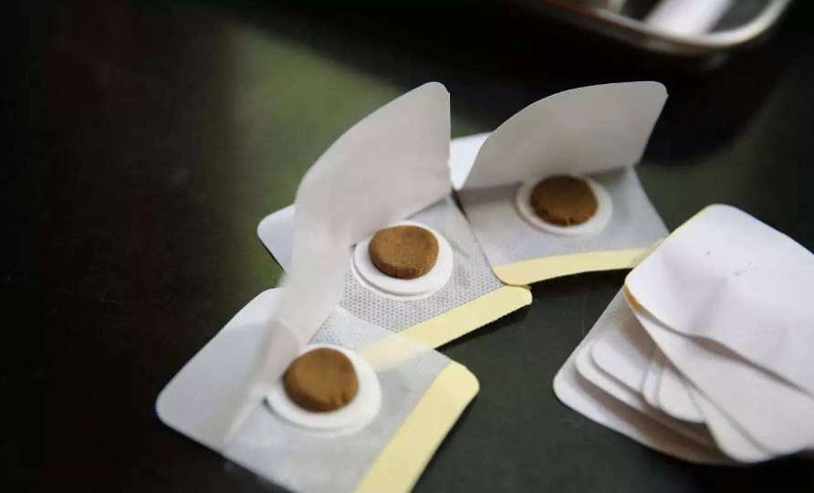 貼三伏貼能不能治療過敏 2018冬病夏治三伏貼有用嗎