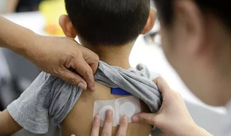 三伏貼對小孩瘦弱有幫助嗎2018 三伏貼對孩子年齡有限制嗎 三伏貼對小孩瘦弱有幫助嗎2018 三伏貼對孩子年齡有限制嗎