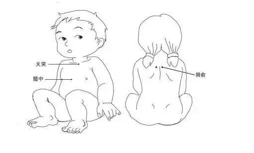 三伏貼對小孩瘦弱有幫助嗎2018 三伏貼對孩子年齡有限制嗎 三伏貼對小孩瘦弱有幫助嗎2018 三伏貼對孩子年齡有限制嗎